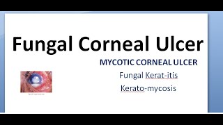 Ophthalmology 115 a Fungal Corneal Ulcer Mycotic Keratitis KeratoMycosis Eye treatment fungus anti [upl. by Dorlisa]