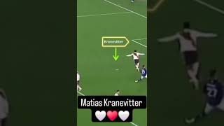 Matias Kranevitter Lo mejor que verás hoy [upl. by Ursola36]