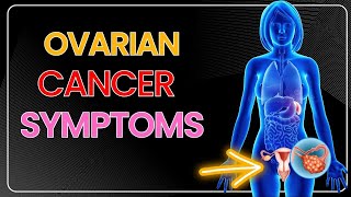 10 Ovarian Cancer Signs and Symptoms [upl. by Manheim]