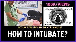 HOW TO INTUBATE INTUBATION PROCEDURE amp TECHNIQUE [upl. by Oys692]