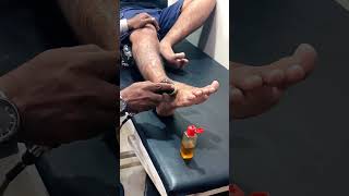 Ultrasonic physio 🦴 for talus bone fracture 😣 healing talusbone healthtips physiotherapy tips [upl. by Adan]