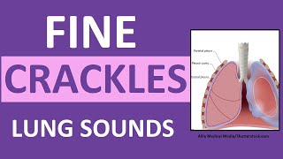 Crackles Fine Lung Sounds  Crackles and Rales Breath Sounds Abnormal [upl. by Mian]