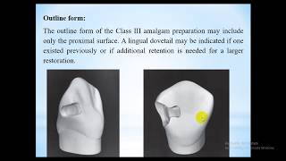 CL III amalgam restoration  Lec 6 [upl. by Zillah]