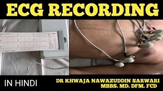 ECG Recording Procedure  In Hindi physiology cardiology mbbs medicine ecg Doctors Corner [upl. by Immanuel]