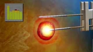 Novilase® Interstitial Laser Therapy Procedure Animation [upl. by Attelrak]