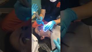 Kor Whitening Live at Shades Creek Dental [upl. by Perri256]