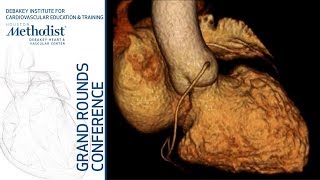 Multimodality Imaging of Percutaneous Left Atrial Appendage Muhamed Saric MD November 1 2018 [upl. by Sabelle769]