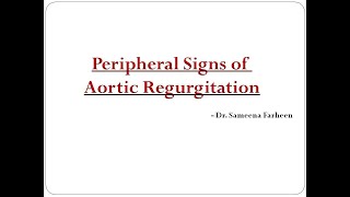 Peripheral signs of Aortic Regurgitation Dr Sameena Farheen [upl. by Anilosi]