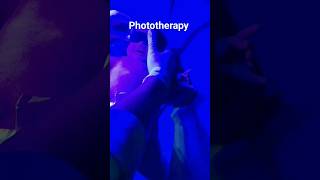 neonatal jaundice phototherapy treatment babyCareWithDRBhushan babyreels ytshorts [upl. by Hughett943]