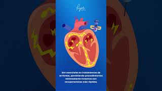 Las cánulas de ablación son dispositivos clave en el tratamiento de arritmias cardíacas [upl. by Llehcsreh]