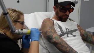 Tattoo Artist Gets Tattoo Removal on Sleeve  First Treatment [upl. by Etireuqram]