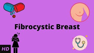 Fibrocystic Breast Causes Signs and Symptoms Diagnosis and Treatment [upl. by Dionis]