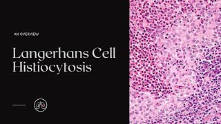 What is Langerhans Cell Histiocytosis [upl. by Coleen58]