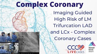 Imaging Guided High Risk of LM Trifurcation LAD and LCx  Complex Coronary Cases  February 19 2019 [upl. by Araf]