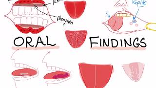 Oral lesions and diseases associated with them [upl. by Eolande]