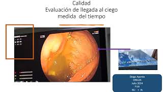 IA en endoscopia digestiva [upl. by Ivar106]