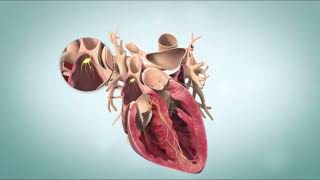 Ventricular Fibrillation VFib Terminal Cardiac Rhythm [upl. by Silliw]