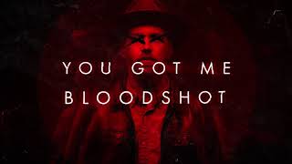 Sam Tinnesz  Bloodshot Official Lyric Video [upl. by Ennasus]