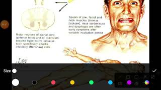 Tetanus toxin mode of action explained [upl. by Esylle]