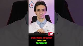 Skin fungal infection what does it look like and how to cure it [upl. by Aietal]