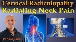 Cervical Radiculopathy Radiating Neck Pain  Dr Mandell Live Stream [upl. by Ahsiekel]