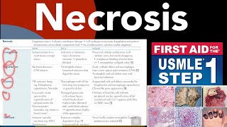 Necrosis Coaglative Liquefactive Caseous Fat Fibrinoid necrosis in HindiUrdu by first aid [upl. by Aehtrod]