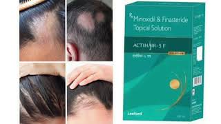 ACTIHAIR 5 F Topical Solution Minoxidil amp Finasteride Topical Solution [upl. by Adnohsad]