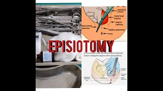 EPISIOTOMY EPISIOTOMY TRAYINSTRUMENTEASY EXPLANATIONSUSES [upl. by Grimes]