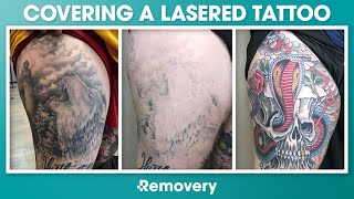 Laser Tattoo Removal Cover Up Before And After  Motivation Monday  Removery [upl. by Oznarol]