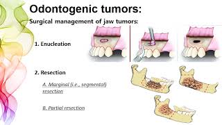 Odontogenic Tumors section 1  DR NOOR SAHBAN FOURTH GRADE [upl. by Ennairac]