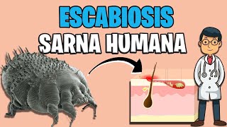 SARNA HUMANA  ESCABIOSIS sintomas TRATAMIENTO 2023  Sarcoptes Scabiei ✅ [upl. by Aileahcim]