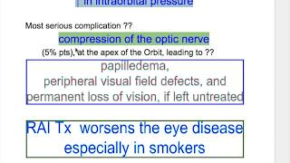 Exophthalmos Thyroid Ophthalmopathy [upl. by Mintz174]