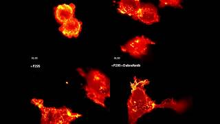 Increased lamellipodia formation in response to a cancer drug [upl. by Llednar]