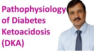 Diabetes Ketoacidosis DKA  Pathophysiology [upl. by Anolla]