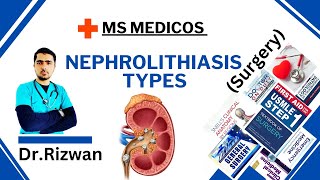 NephrolithiasisSurgeryMS MedicosDr RizwanUrdu Hindi Easy Explanations [upl. by Eilegna]