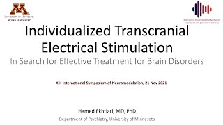 Individualized Brain Stimulation 13th International Neuromodulation Symposium [upl. by Aisylla]