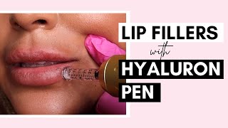 No Needle Lip Filler With Hyaluron Pen  Procedure And Aftercare Ft SaigeWellington [upl. by Anirdnajela789]