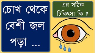 Watering from eyes Types Causes and treatment wateringeye epiphora lacrimation doctorSight [upl. by Trebmer]