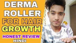 Derma Roller For Hair Growth   Hindi  Does Derma Roller Really Work For Hair Loss  Honest Review [upl. by Joan]