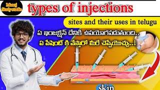 Types Of Injections Sites and Uses Common Injections and Their Uses manojstudystudio [upl. by Conchita]