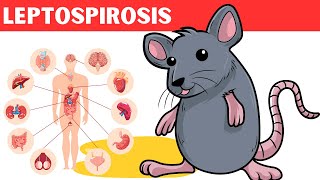 Leptospirosis  Causes Risk Factors Pathology Signs amp Symptoms Diagnosis And Treatment [upl. by Ivan]