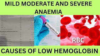 LOW HBHEMOGLOBINCAUSES SYMPTOMSCLASSIFICATION OF ANEMIAMILD MODERATE AND SEVERE ANAEMIA [upl. by Ellehcor179]