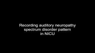 Auditory Neuropathy Spectrum Disorder ANSD Recorded in the NICU with Vivosonic Integrity System [upl. by Steve]