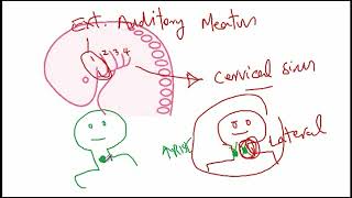 USMLE ACE Video 134 Thyroglossal Duct Cyst vs Branchial Cleft Cyst [upl. by Ennayar]