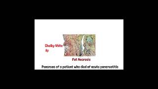 Cell Injury Pathology  Reversible and Irreversible Cell Injury  Part 2 doctor mbbs anatomy [upl. by Radke]