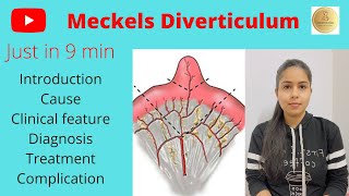 Meckels diverticulum in Hindi Cause Symptoms Dd Investigation Tt Learn with Dr Shipra [upl. by Aneetak647]