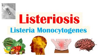 Listeriosis Listeria Monocytogenes  Sources Pathophysiology Symptoms Diagnosis Treatment [upl. by Annav]