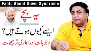 Down Syndrome Trisomy 21  Causes Symptoms amp Diagnosis  Dr Khalid Jamil [upl. by Nogem]