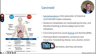 Understanding Carcinoid Syndrome in Gastrointestinal Cases [upl. by Occer945]