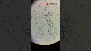 Grampositive Bacilli 100X in compound microscope  clinical microbiology  microbiology [upl. by Llibyc317]